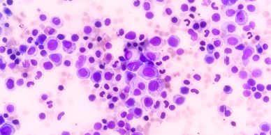 Microscopic image of clustered purple cells.