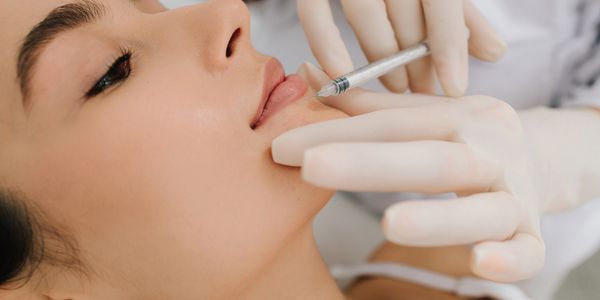 lip enhancement using RHA® Collection ar Royal aesthetics & Injectables Phoenix AZ