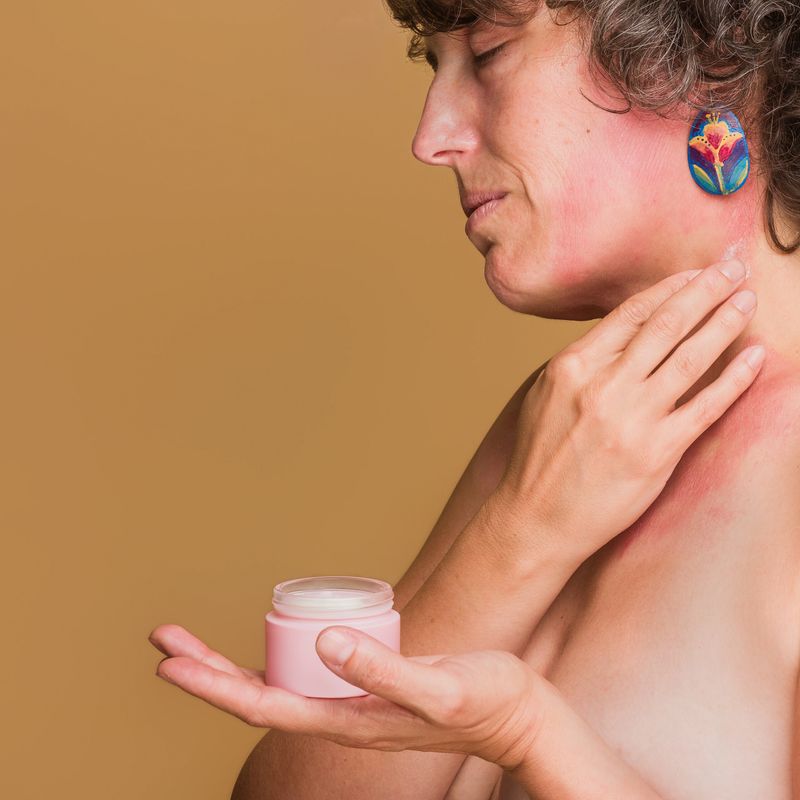Middle-aged woman with sensitive skin and sunburn applying hydrating lotion on her shoulder, practicing self-care