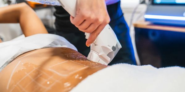 Body contouring treatment being performed.