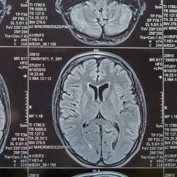 Diagnostic & Imaging Equipment China Sourcing Sinotrans Medical Technology Tianjin and Helixion 