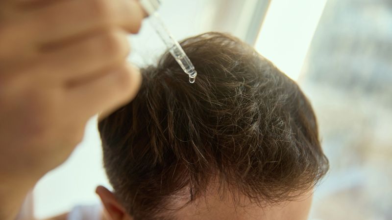 Close view of applying nourishing liquid serum onto hair roots. Concept of hair-care branding, grooming tutorials, wellness platforms and targeted scalp-care visuals.