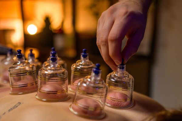 Hand placing glass cups for cupping therapy on a person's back.