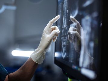 Gloved hand pointing at medical images on a screen.