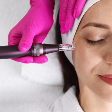 microneedling facials, spa near me, whiterock, south surrey, microneedle, facial massage, acupunctur