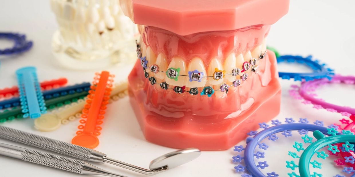 Dental model with colorful braces and orthodontic tools.