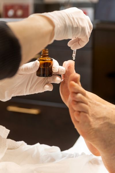 Applying liquid medicine on a foot with a dropper.