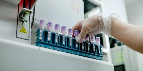 Blood samples for iron and ferritin lab testing