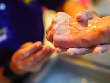 Hands applying a gel or cream to an arm.