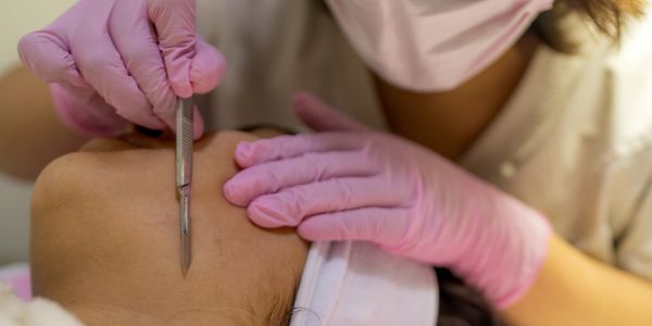 Professional facial treatment using tweezers.