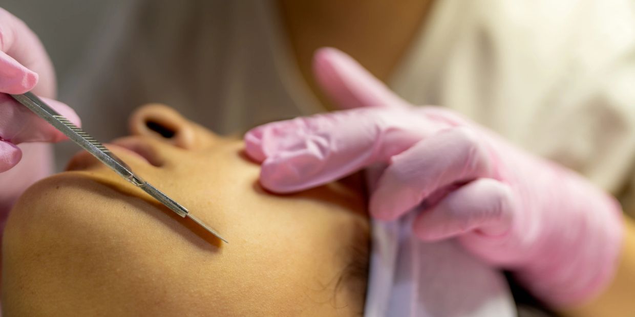 Close-up of a facial skin treatment with a scalpel.