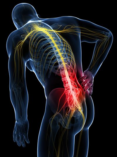 Patient finding relief from Nerve Irritation / Trapped Nerves at Tenby Chiropratic