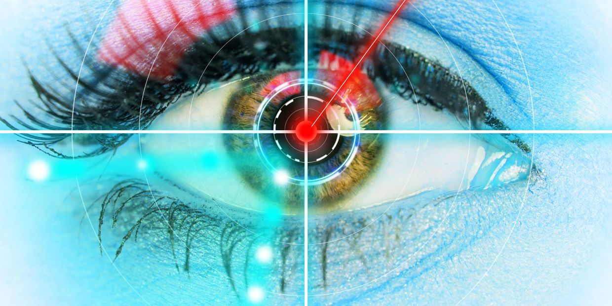 Keratopigmentation Surgery Illinois 424-478-9157