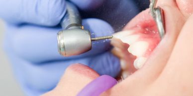 Free Dental Check Up