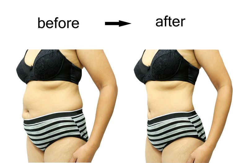 Woman's body before and after a diet