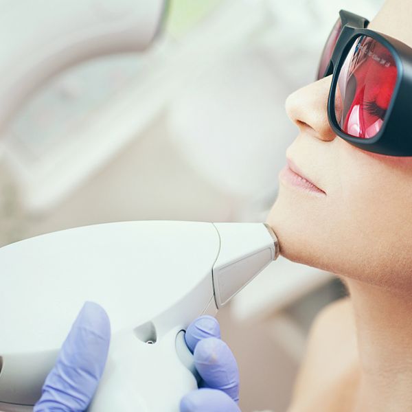 Woman undergoing laser skin treatment on her chin.