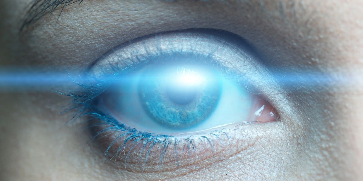 Keratopigmentation Surgery Florida 424-478-9157