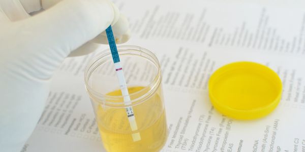 Urine Drug/Alcohol Testing