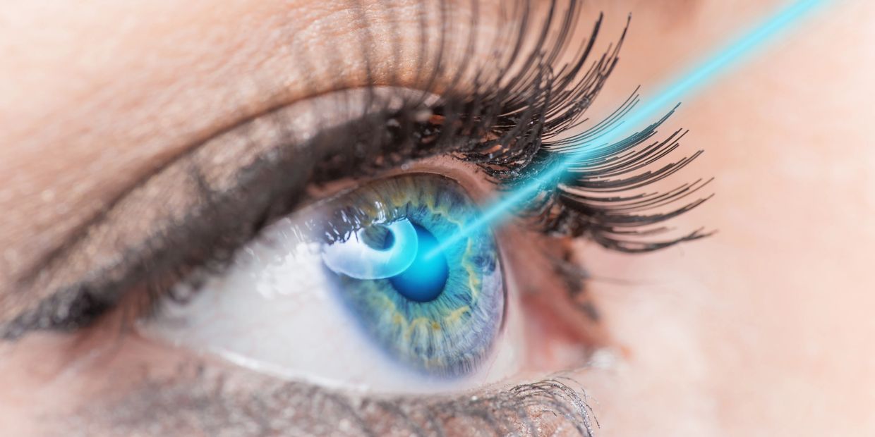 Keratopigmentation Surgery Idaho 424-478-9157