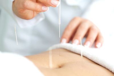 Acupuncture for IVF and IUI
