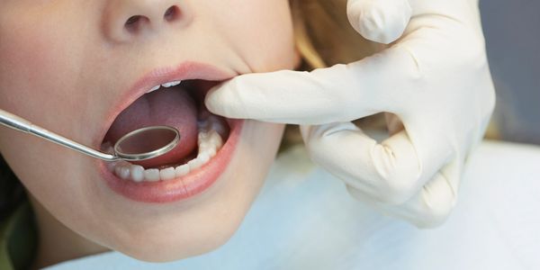 Dentist examining a patient's teeth with a mirror.