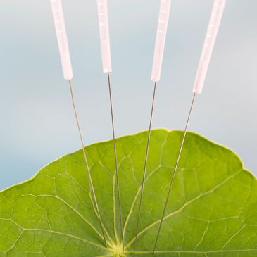 Four acupuncture needles inserted into a green leaf.