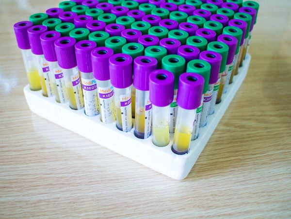 Test tubes with purple and green caps in a white rack on a wooden surface.