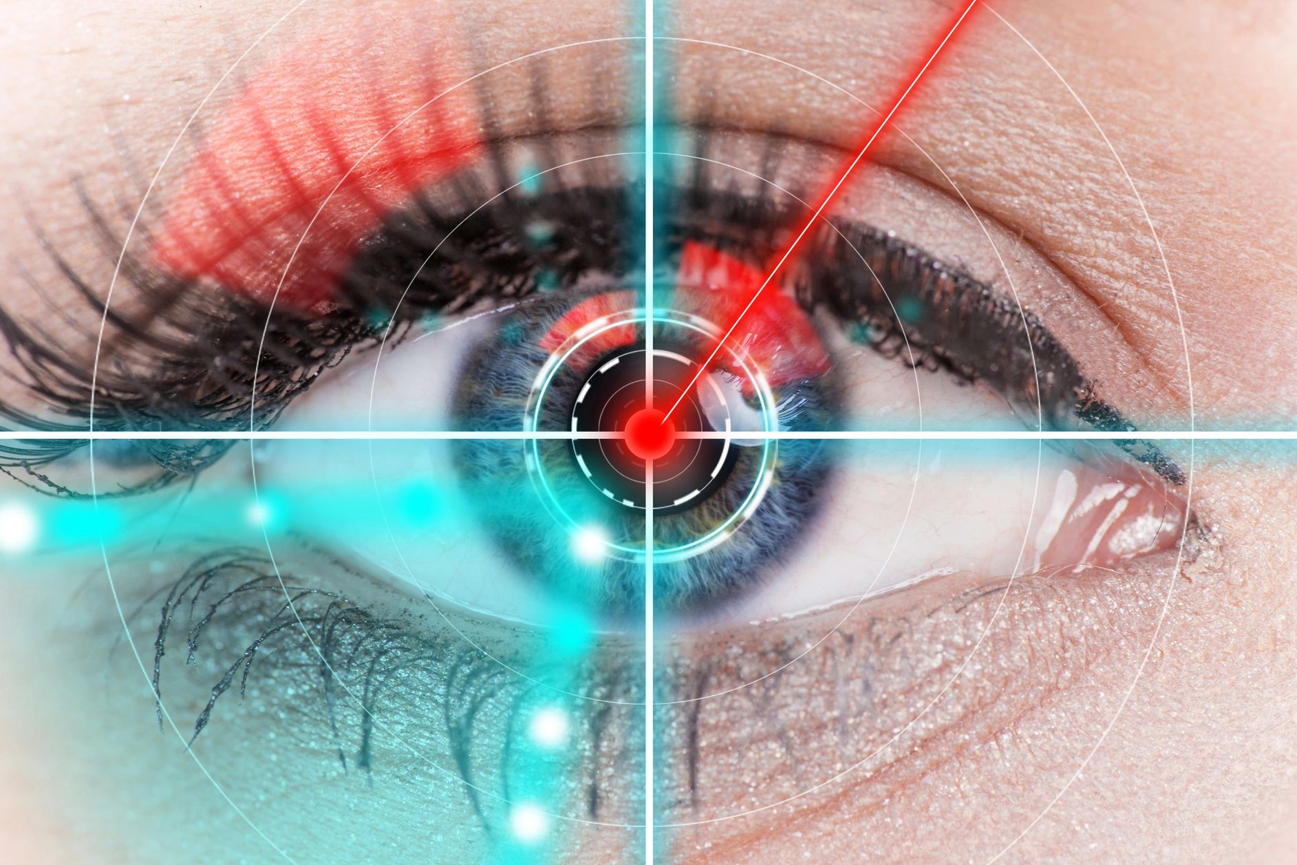 Eye Color Change In Indiana