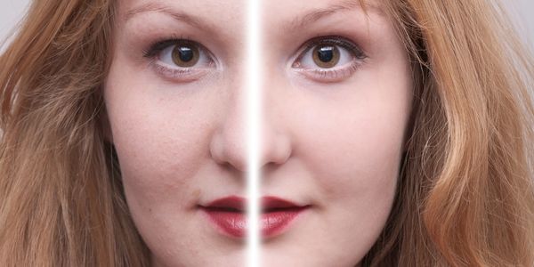 Split face showing natural skin on one side and airbrushed smooth skin on the other.
