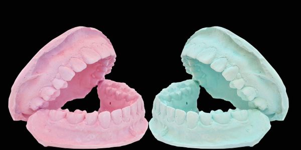 Two pastel-colored dental molds facing each other on a black background.