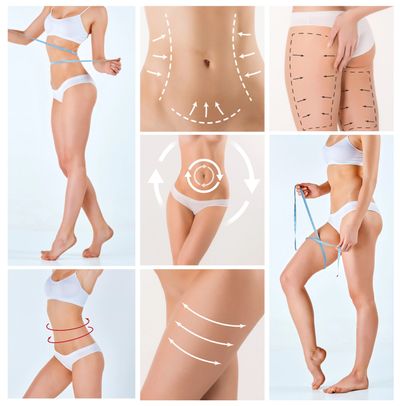 Liposuction remains one of the most popular body-contouring procedures—yet in the U.S. you’re lookin