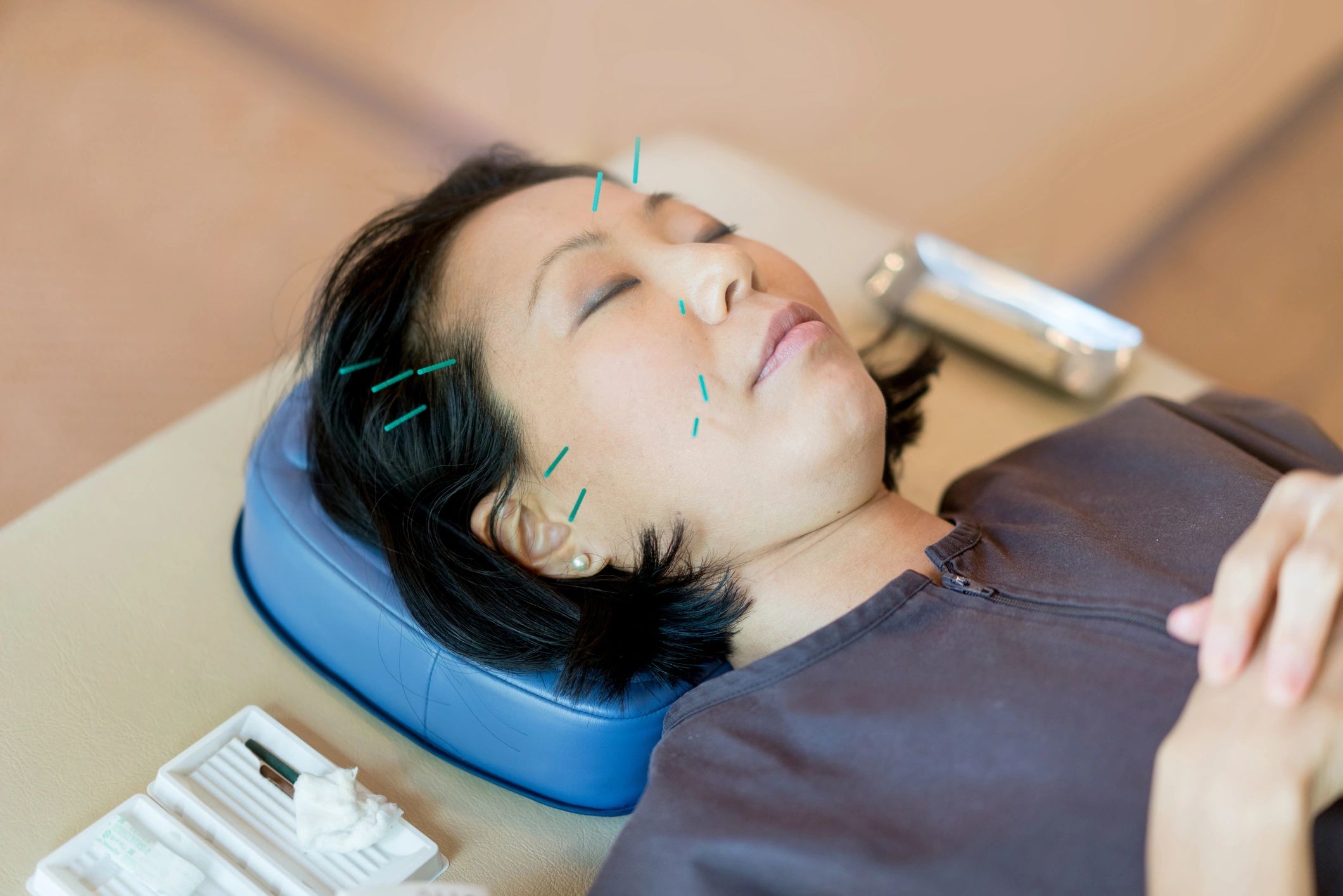 How Acupuncture Helps Prevent Heat Stroke