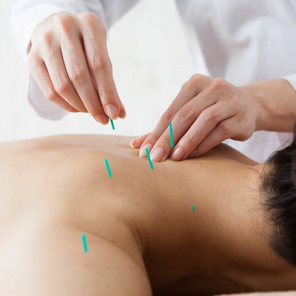 Upper back pain, santa ana acupuncture tustin ca