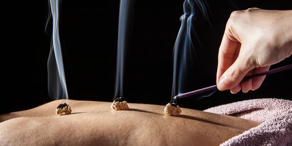 Moxibustion Therapy