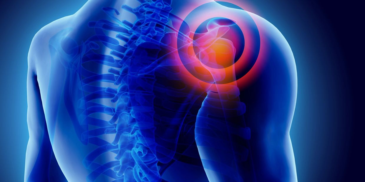 Ilustración de dolor en el hombro y columna vertebral.