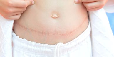 lymphatic drainage, gentle scar massage, and therapeutic ultrasound to soften scar tissue