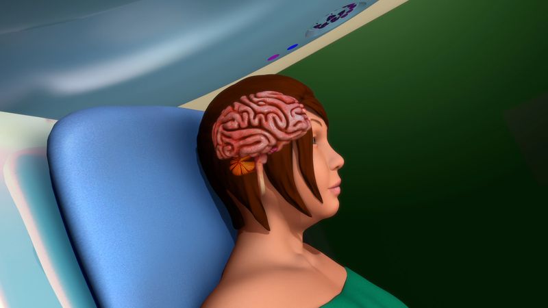 Magnetic resonance imaging (MRI) is a type of scan that uses strong magnetic fields and radio waves to produce detailed images of the inside of the body.