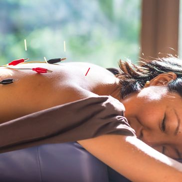Woman receiving electroacupuncture therapy while resting peacefully.