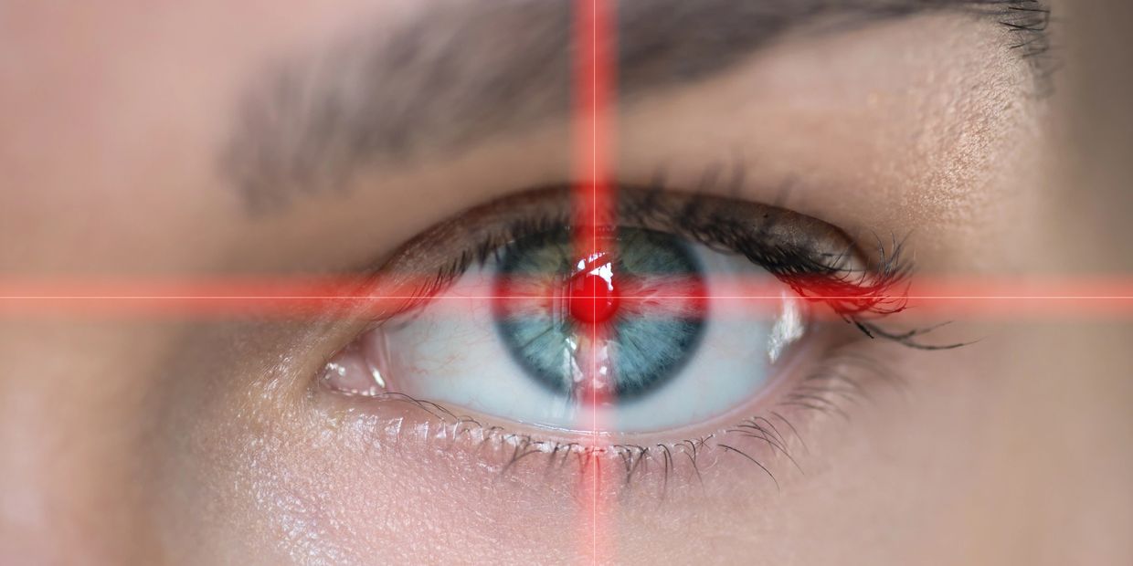 Keratopigmentation Surgery Colorado 424-478-9157