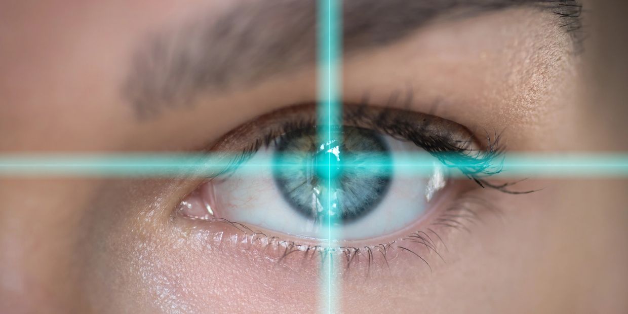 Keratopigmentation Surgery Georgia 424-478-9157