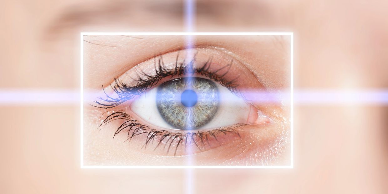 Keratopigmentation Surgery Hawaii 424-478-9157