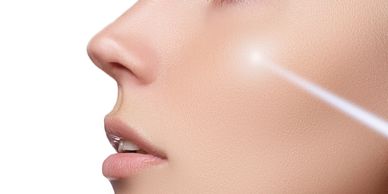 Close-up of facial skin with laser treatment.