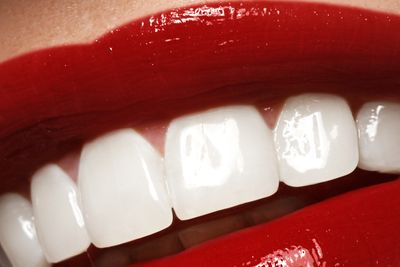 Beautiful, bright smile. Clean, whitened teeth. 