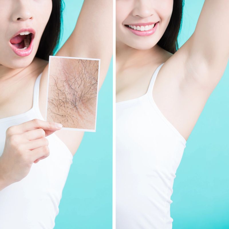 beauty woman take picture with under armpit problem before and after