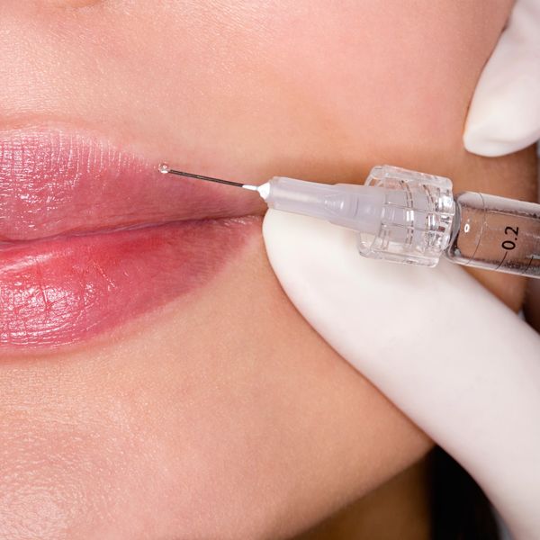 MEDICINA ESTÉTICA EN FUENLABRADA