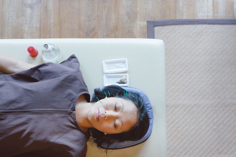 Patient receiving acupuncture treatment