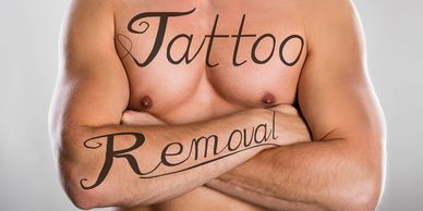 Muscular man with crossed arms and tattoo removal text on chest and arm.