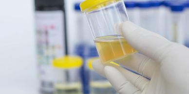 Hand holding a urine sample container in a lab.