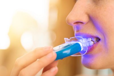 Cosmetic dental whitening service at Myrtle Dental Clinic