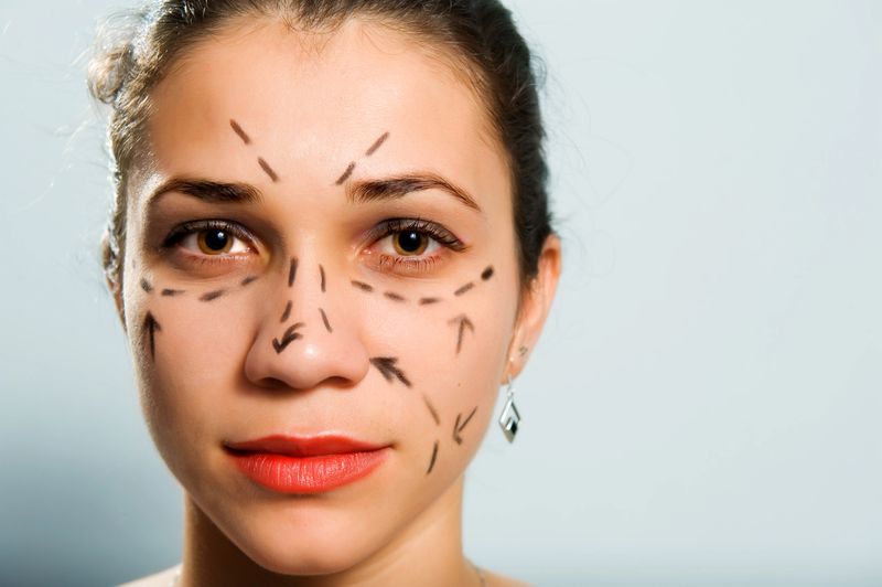 Marked face for plastic surgery